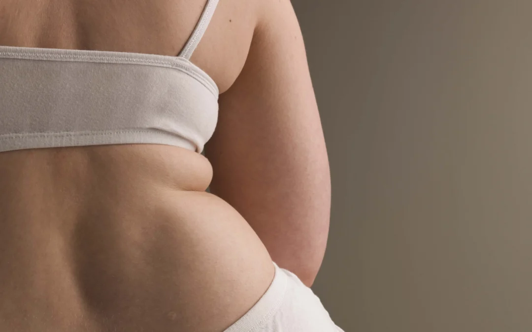 ENFERMEDADES ASOCIADAS A LA OBESIDAD